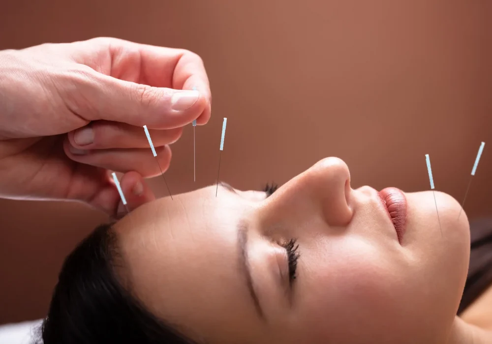 Skapa en hemsida till Akupunktur
